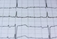 luminous growth node 695687237